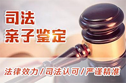 邯郸司法DNA亲子鉴定如何办理，邯郸司法DNA鉴定机构电话地址在哪里