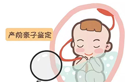 贵州怎么做产前亲子鉴定