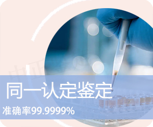 DNA同一认定